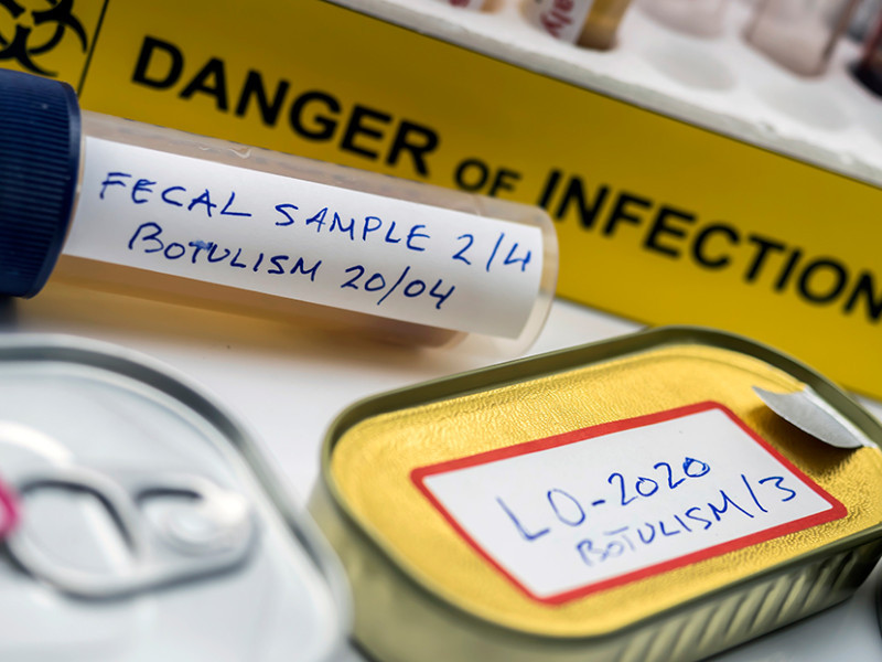 Botulism